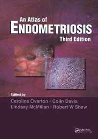 An Atlas of ENDOMETRIOSIS