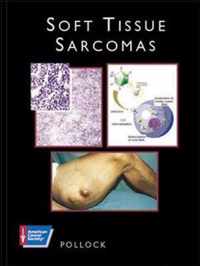 SOFT TISSUE SARCOMAS (AMERICAN CANCER SOCIETY ATLAS OF CLINICAL ONCOLOGY)