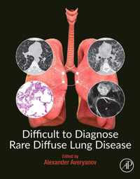 Difficult to Diagnose Rare Diffuse Lung Disease