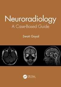 Neuroradiology