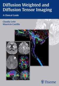 Diffusion Weighted and Diffusion Tensor Imaging