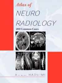 Atlas Of NEURORADIOLOGY