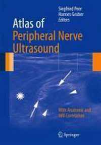 Atlas of Peripheral Nerve Ultrasound