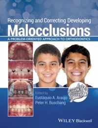 Recognizing & Corecti Deve Malocclusions