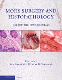 Mohs Surgery and Histopathology