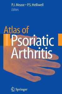 Atlas of Psoriatic Arthritis