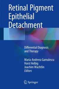 Retinal Pigment Epithelial Detachment