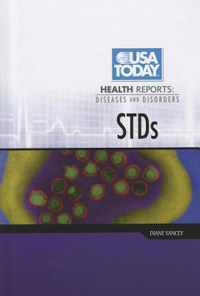 STDs