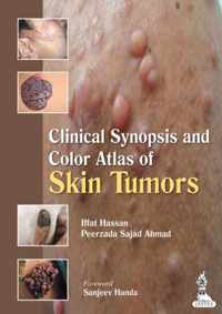 Clinical Synopsis and Color Atlas of Skin Tumors