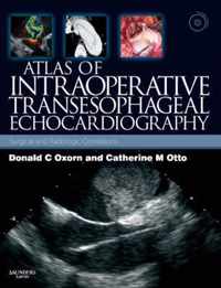 Atlas of Intraoperative Transesophageal  Echocardiography