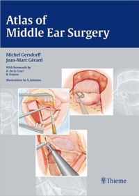 Atlas of Middle Ear Surgery