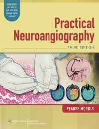 Practical Neuroangiography