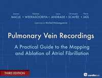 Pulmonary Vein Recordings