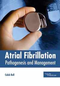 Atrial Fibrillation