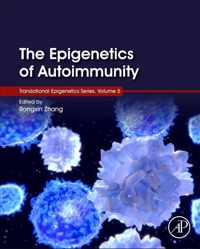 The Epigenetics of Autoimmunity