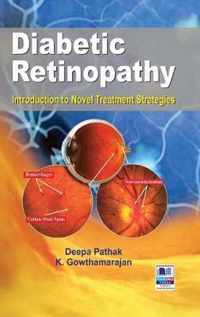 Diabetic Retinopathy