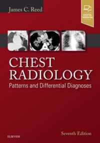 Chest Radiology