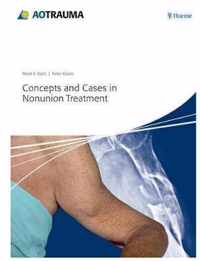 Concepts and Cases in Nonunion Treatment