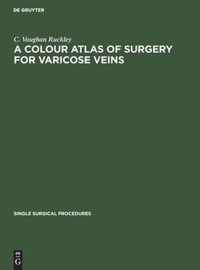 A Colour Atlas of Surgery for Varicose Veins