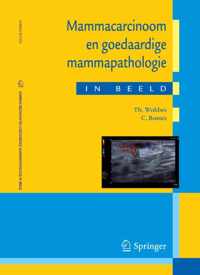 Mammacarcinoom en goedaardige mammapathologie in beeld