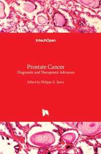 Prostate Cancer