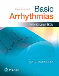 Basic Arrhythmias