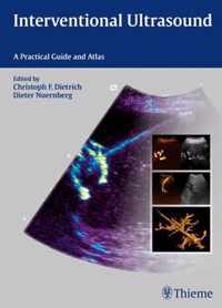 Interventional Ultrasound