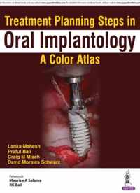 Treatment Planning Steps in Oral Implantology