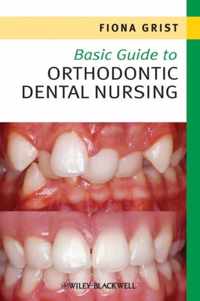 Basic Guide to Orthodontic Dental Nursing