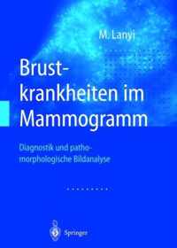 Brustkrankheiten Im Mammogramm