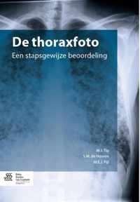 De thoraxfoto