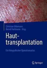 Hauttransplantation