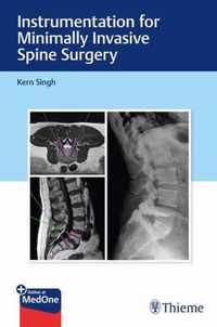 Instrumentation for Minimally Invasive Spine Surgery