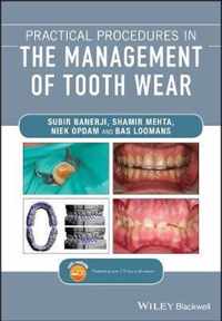 Practical Procedures in the Management of Tooth Wear