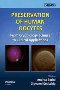 Preservation of Human Oocytes