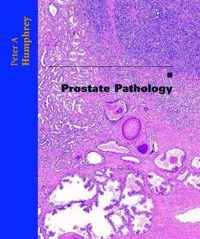 Prostate Pathology