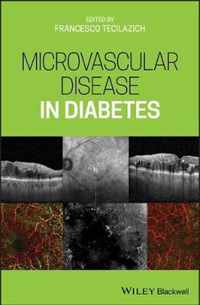 Microvascular Disease in Diabetes