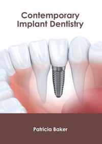 Contemporary Implant Dentistry