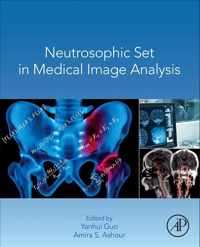 Neutrosophic Set in Medical Image Analysis