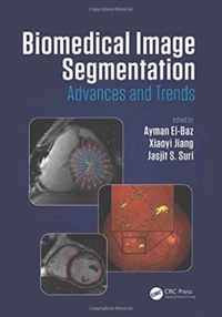 Biomedical Image Segmentation