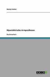 Myoelektrische Armprothesen