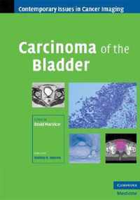 Carcinoma of the Bladder