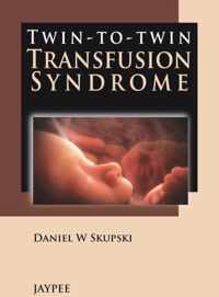 Twin-to-Twin Transfusion Syndrome