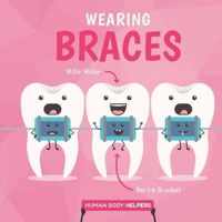 Wearing Braces