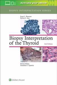 Biopsy Interpretation of the Thyroid