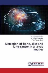 Detection of bone, skin and lung cancer in a x-ray images