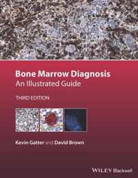 Bone Marrow Diagnosis