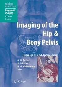 Imaging of the Hip & Bony Pelvis