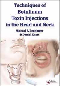 Techniques of Botulinum Toxin Injections in the Head and Neck