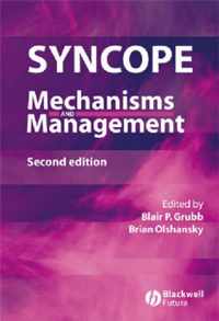 Syncope